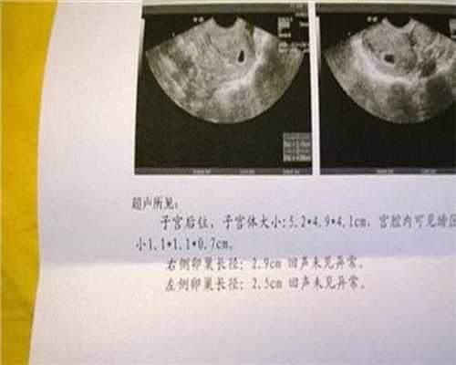 武汉代怀孕产子价格_孕期胎教指导 什么是胎教仪