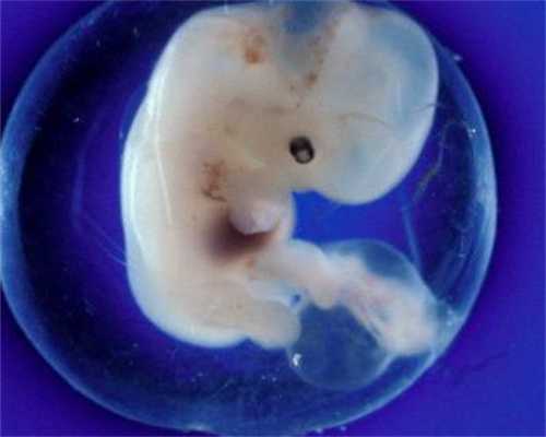 哪里有代孕人可找_二次剖腹产子宫是原切口吗