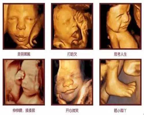 武汉代孕最低价格_代孕宝宝在哪里_代孕孩子qq群是多少